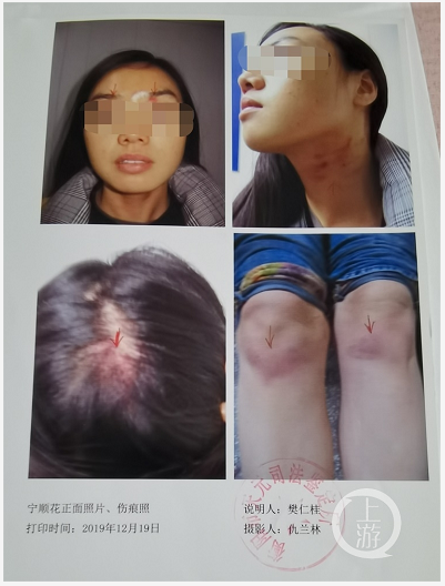 5年4次起诉离婚均被驳回！男方嗜赌家暴，还多次扬言要报复？